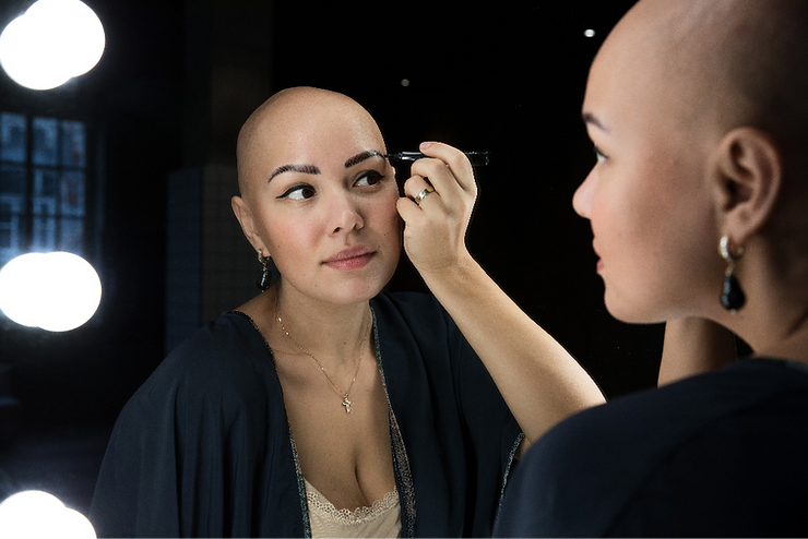 Microblading for Alopecia